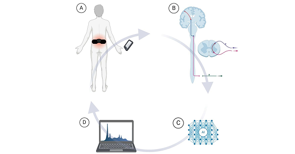 New Publication: Transforming Chronic Pain Management with Neuromodulation & Monitoring