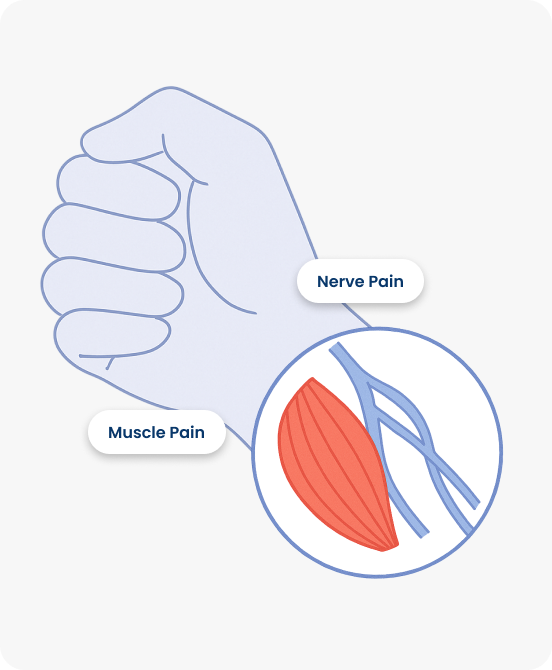 muscle-nerve